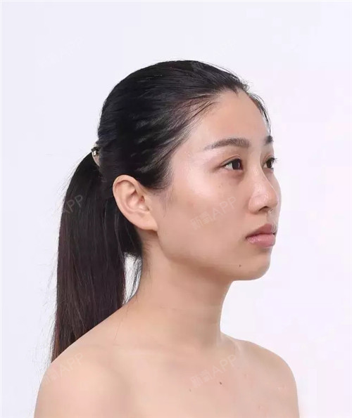 从小到大我都属于相貌平平的那种女孩,所以每每看到那_圈子-新氧美容