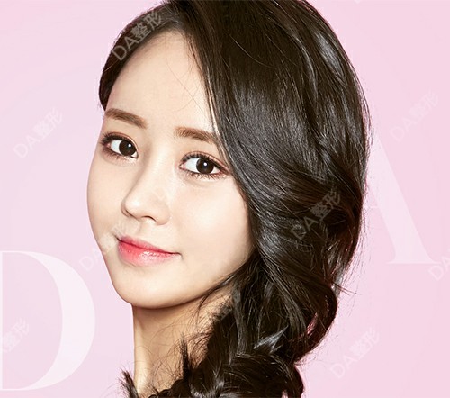 韩国da整形-眼睑下至让眼睛更大更美 下眼睑下至这_圈子-新氧美容整形