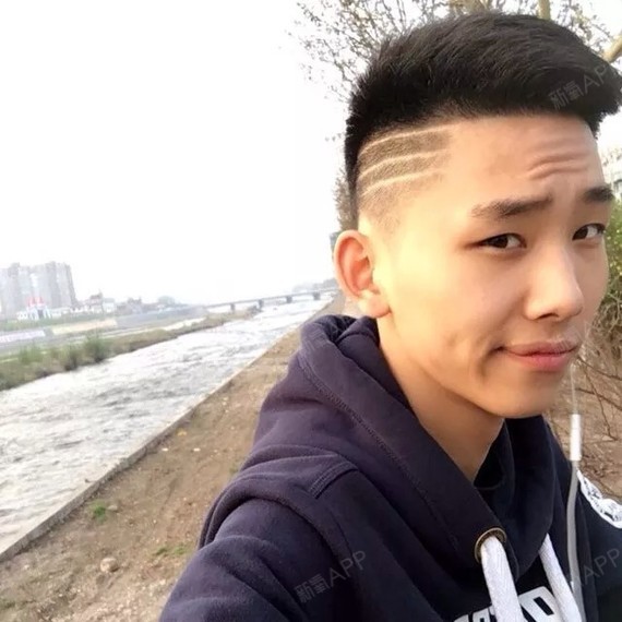 北京阴茎增大好不好_效果图_习惯了尔的习惯阴茎增大术后第22天_新氧