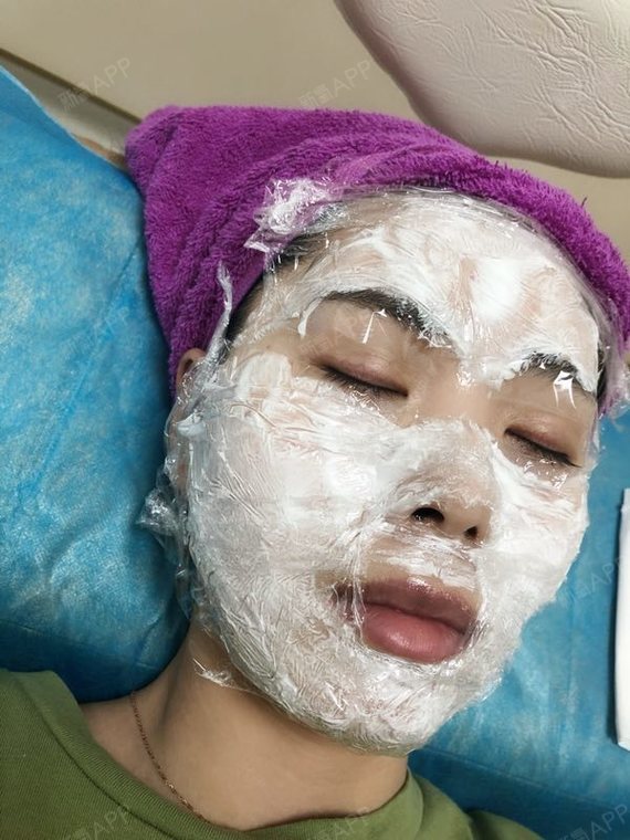 小草莓030微针美塑第30天美丽日记