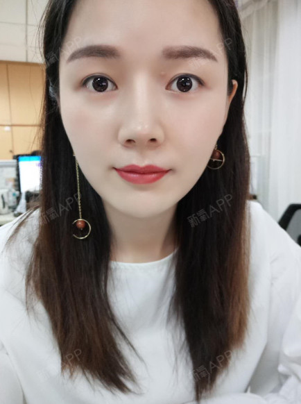 【半永久纹唇术后第15天】