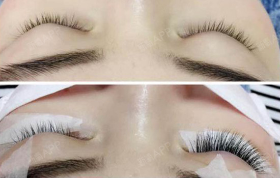 嫁接睫毛前后对比照 嫁接睫毛后立刻拥有浓密长睫毛