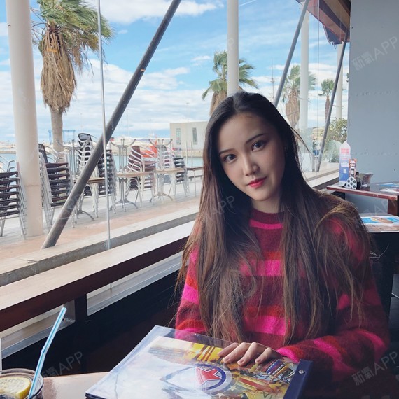 北京切开双眼皮好不好_效果图_雅西本本切开双眼皮术后第20天_新氧