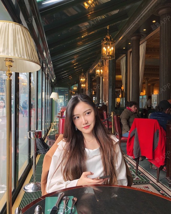 北京切开双眼皮好不好_效果图_雅西本本切开双眼皮术后第20天_新氧