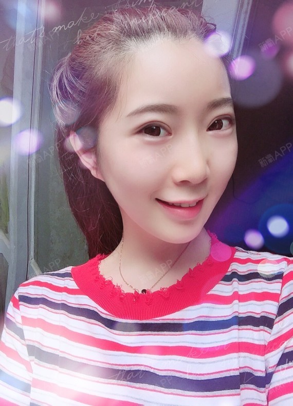 瘦脸针已经六天了,但是感觉瘦脸针真的是效果挺明显的_圈子-新氧美容