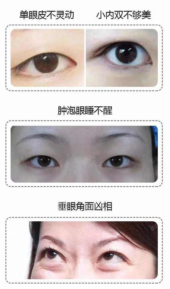 眼皮可以让颜值翻倍!眼睛对于颜值的重要性,想