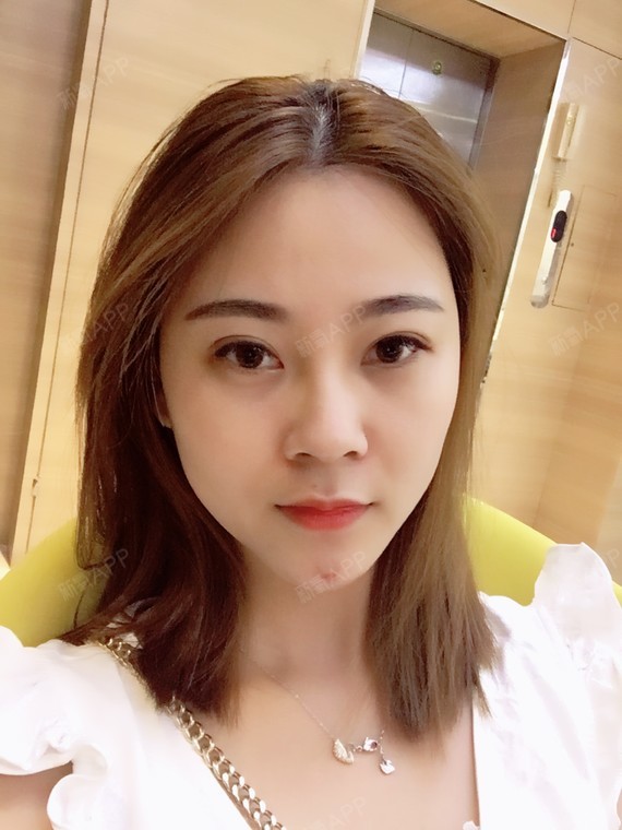 术后都有一个半月了,看着自己的脸真是越来越好看了,_圈子-新氧美容