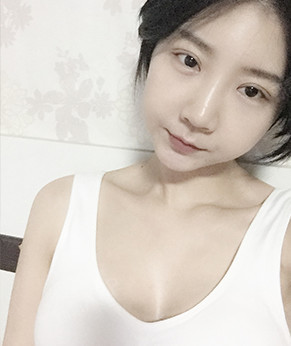 做完丰胸已经18天了,感觉效果还挺不错的,胸部明显_圈子-新氧美容整形