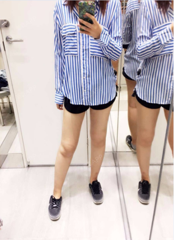 长沙吸脂瘦大腿好不好_效果图_王木木时间飞行吸脂瘦大腿术后第62天