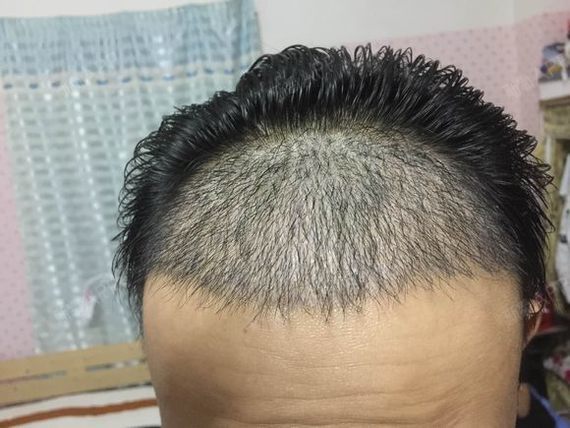 给大家上一组第25天的强弱光下对比吧在强弱光的对比_圈子-新氧美容