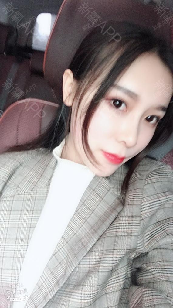 安吉拉贝比皮秒激光第80天美丽日记