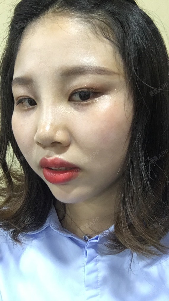 哈哈哈,十天的了鼻子,现在终于有时间化妆了,感觉自己恢复的还是很快