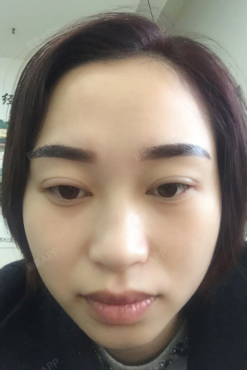 苏州半永久纹眉好不好_效果图_氧气6kk9f71半永久纹眉术后第0天_新氧