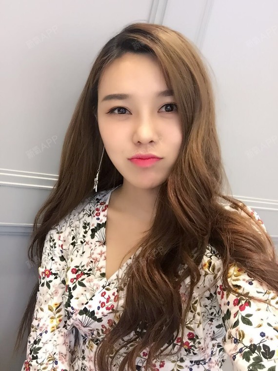 【线雕大v脸】一个月啦,效果很明显,感觉脸小了一圈_圈子-新氧美容