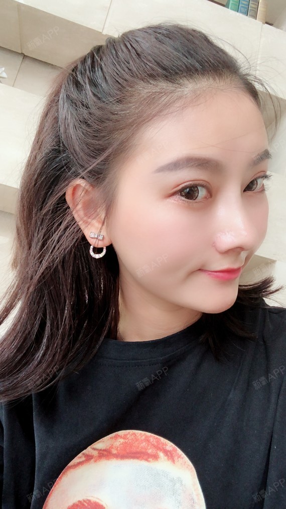 杭州膨体隆鼻好不好_效果图_温梦玉膨体隆鼻术后第28天_新氧美容整形