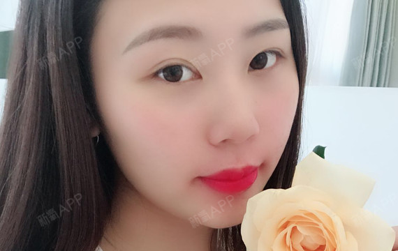 长沙半永久纹唇好不好_效果图_蕾蕾哇半永久纹唇术后第2天_新氧美容