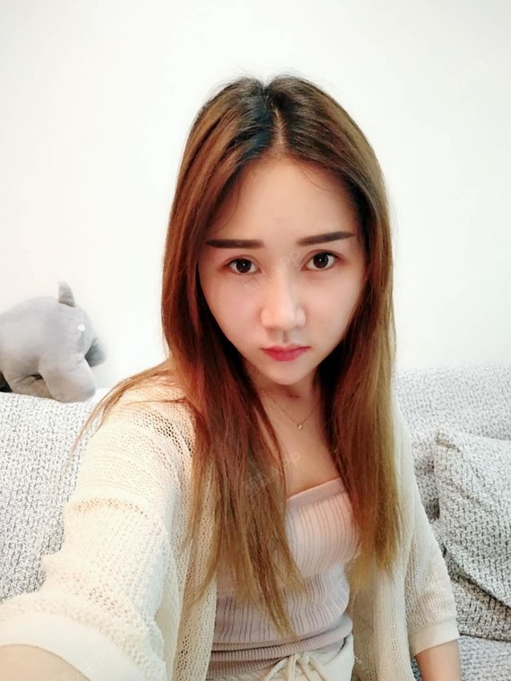 都二十天了,现在是越来月自然了,效果也很明显,看上_圈子-新氧美容