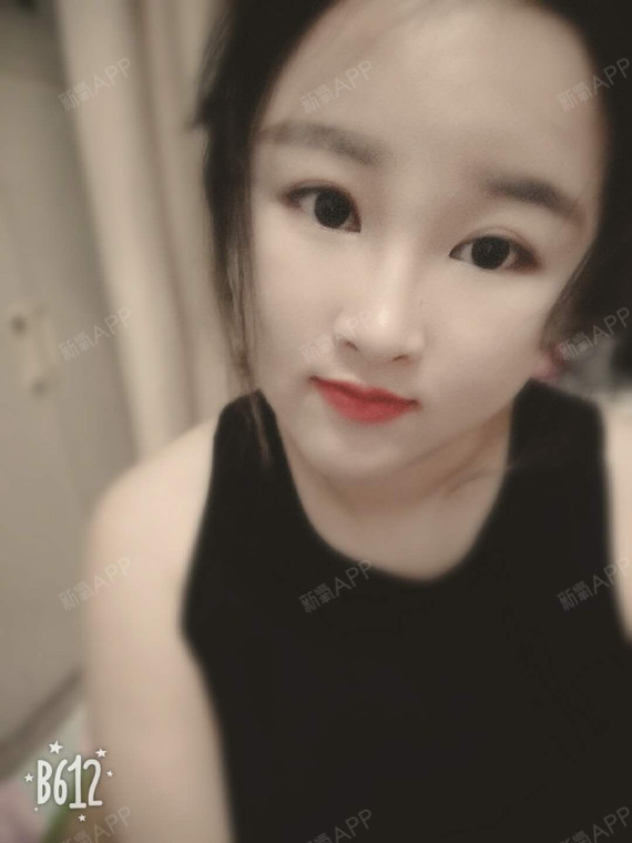 世态炎凉冷暖自知9玻尿酸隆鼻第128天美丽日