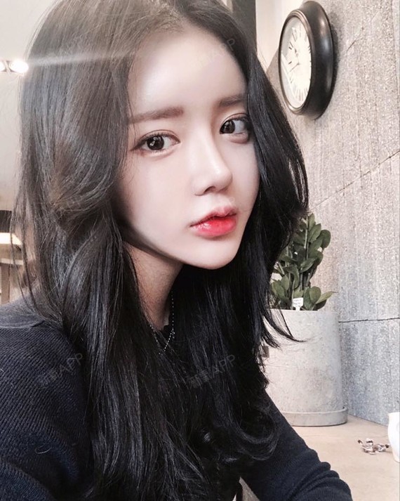 硅胶隆鼻好不好_效果图_可爱的你i硅胶隆鼻术后第88天_新氧美容整形