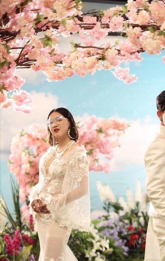 武汉假体隆胸好不好_效果图_氧气vwfc432假体隆胸术后第13天_新氧美容