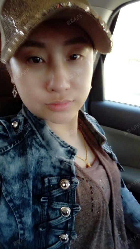 新氧- 邢傲风云 | 鼻部 | 术后当自强 | 郑州同城 | 鼻部综合 | 鼻