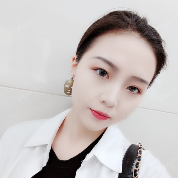 闭月JJ激光去眼袋第7天美丽日记-新氧美容整形