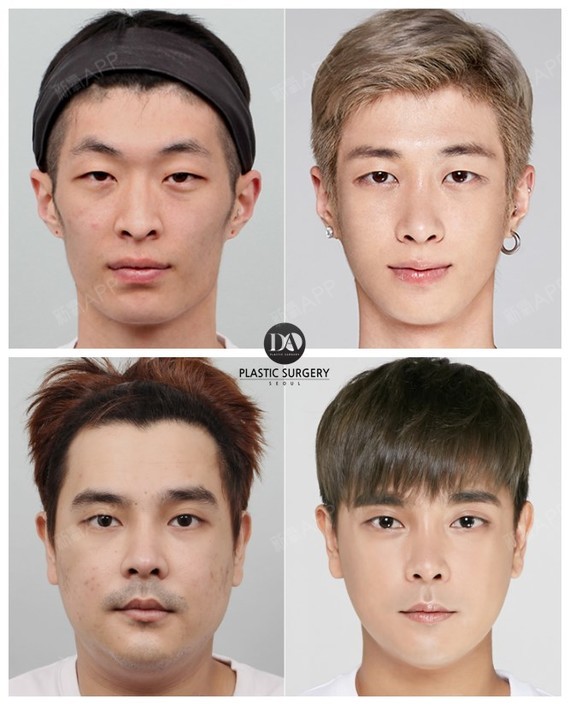 韩国da整形医院最受欢迎的男生脸型