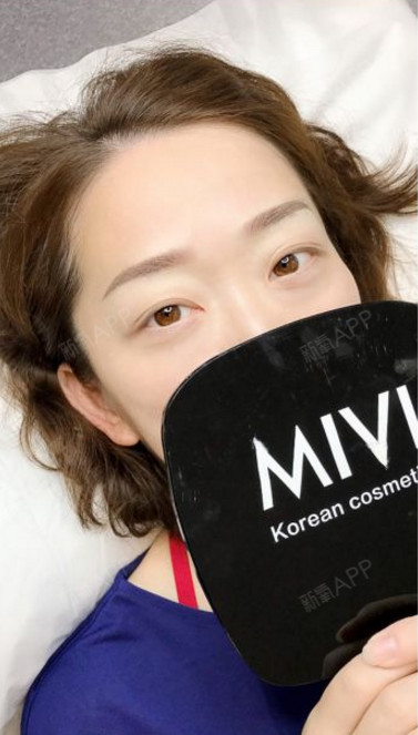 鹿鹿5537半永久纹眉术后第1天美丽日记_新氧整形