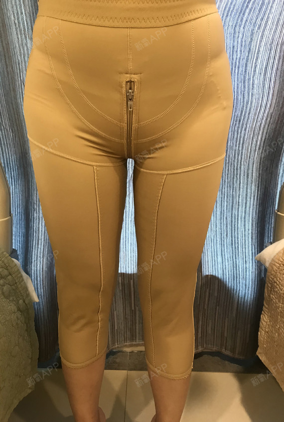 【青岛华颜美-宝丽太黄金微雕大腿吸脂第4天】