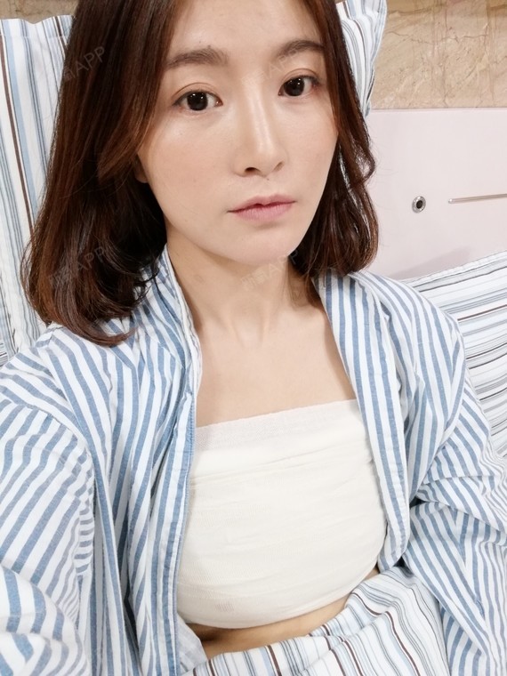 卡布奇诺的爱99假体隆胸术后第7天美丽日记_新氧整形