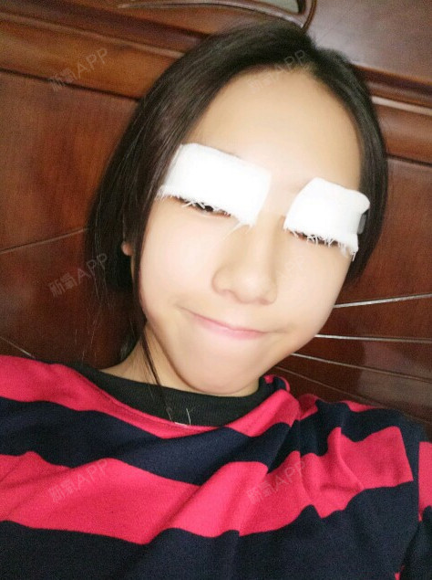 昨天刚做好盖了纱布在眼睛上,医生态度很好而且环境很_圈子-新氧美容