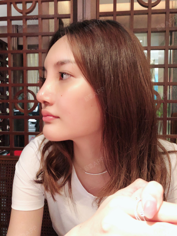 菲菲是一位职场白领,长相甜美_圈子-新氧美容整形