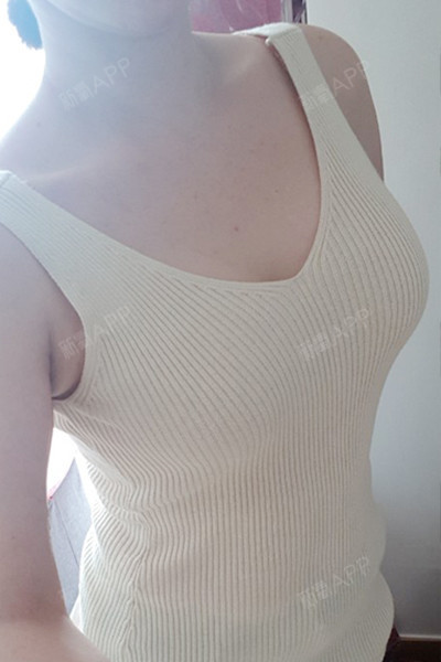 假体隆胸好不好_效果图_九命猫a假体隆胸术后第83天_新氧美容整形