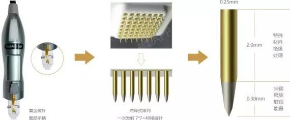 宝丽太黄金微针从奶奶到少奶奶的抗衰神器