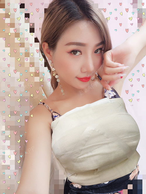 苏州美莱隆胸术后第5天其实一直很想胸部可以丰满一些尝试过美容院里