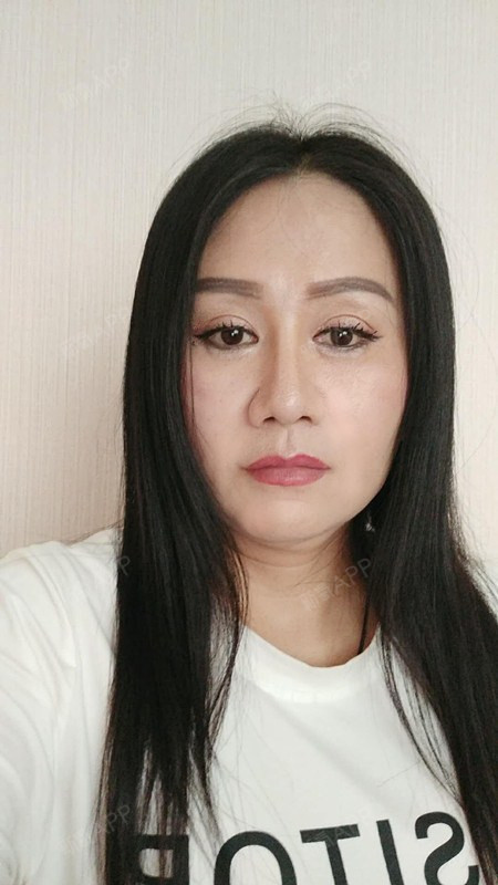 自体脂肪面部填充