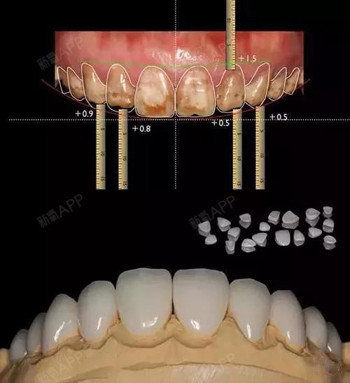 拿起小鏡子,對照我們的國際微笑標準,smile