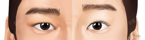 首页 此页面仅支持预览 Avatar 新氧韩国服务站 557篇日记 你们身边有没有长得像男人的女生 也许是你自己 作为女生 当然不会喜欢女生脸上有男性特质 这点总觉得会拖颜值后腿 那 为什么女生讨厌自己脸上的男性特质呢 作为一名女生 从欧尼的角度