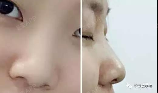 变美模范生 变美模范生
