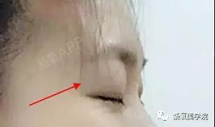 变美模范生 变美模范生