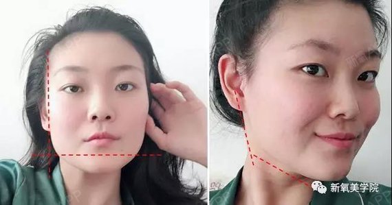 变美模范生 变美模范生