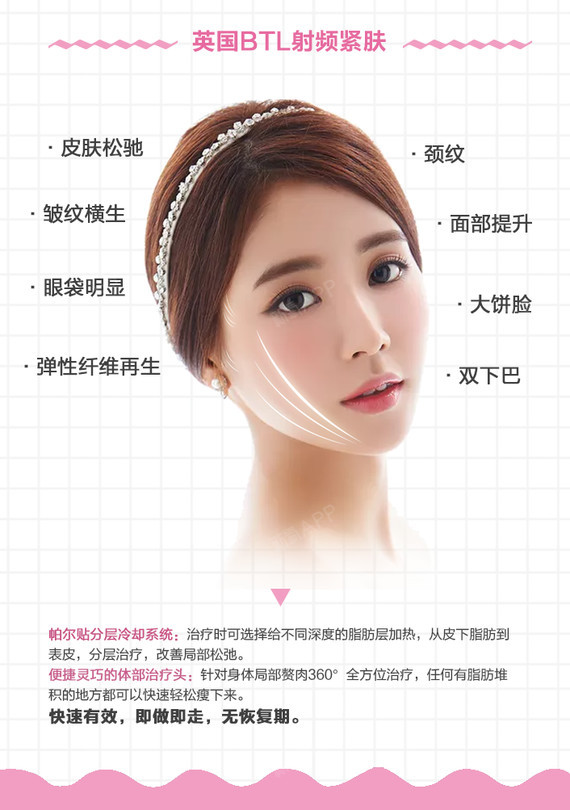 【射频紧肤】英国btl超级射频 衡力肉毒素100单位瘦脸针 v脸女神计划