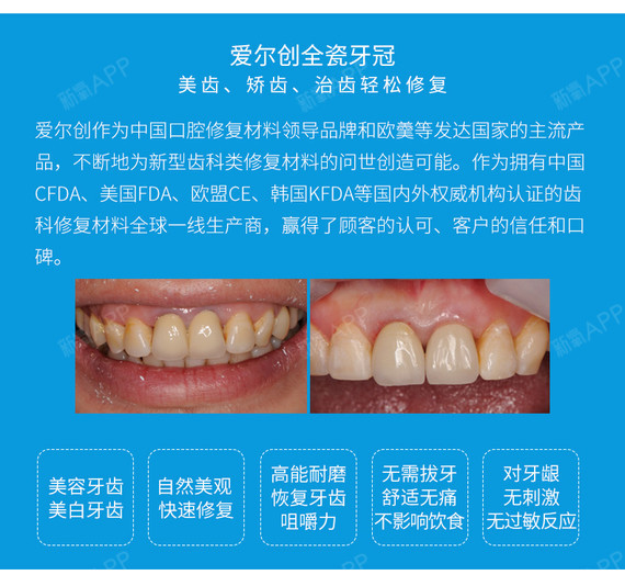 【全瓷牙】拜博口腔 愛爾創全瓷牙冠 鑲牙種牙補牙缺牙牙齒修復牙套