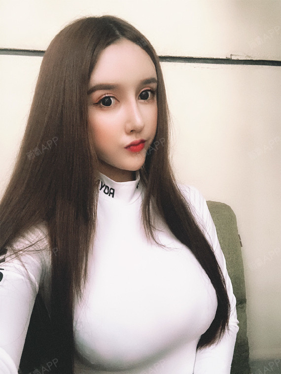 北京假体隆胸好不好_效果图_性感女王假体隆胸术后第82天_新氧美容