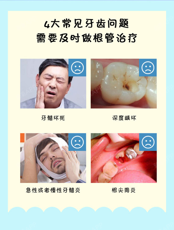 【根管治療】醫保定點單位,根管治療拯救齲壞牙,牙髓炎根尖周炎,壞牙