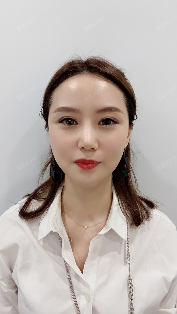 新氧- 大mi | 自体脂肪填充全脸 | 术后当自强 | 深圳同城 | 汕头同城