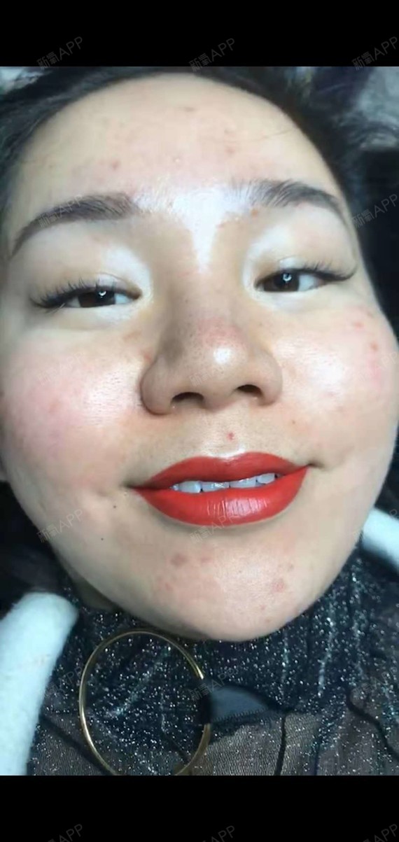 刚刚做完的半永久纹唇,特别满意,感谢美容师,颜色很_圈子-新氧美容