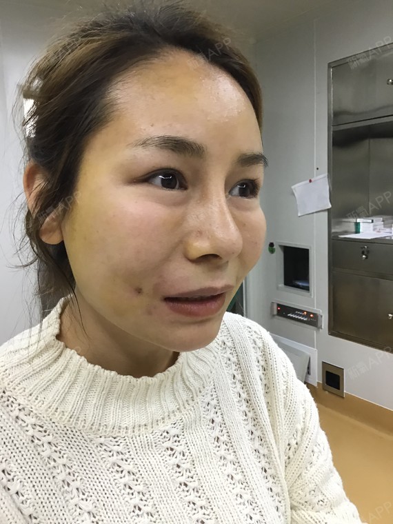 在抖音上看到一个有酒窝的小姐姐,笑起来好好看好甜美,就好羡慕她.
