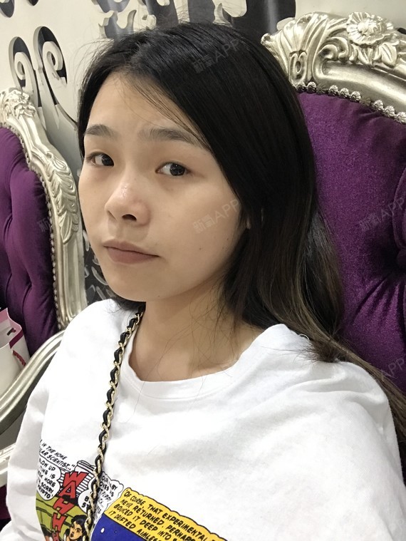 不喜欢自己的眼睛,眼型不好看,眼角下垂.