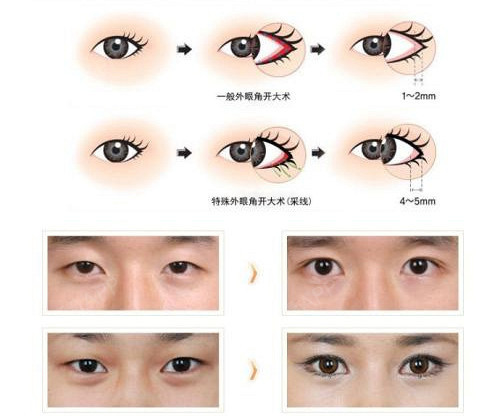 下面为大家介绍一下眼部整_圈子-新氧美容整形